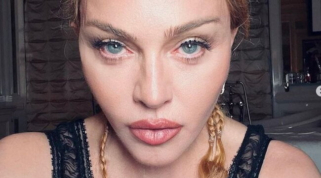 Tanta paura per Madonna che ha rischiato di morire