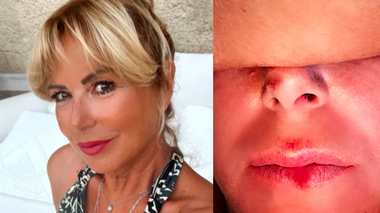 Monica Leofreddi, conduttrice TV, è stata investita e insultata vicino alla Stazione Termini a Roma, suscitando shock e sostegno dai colleghi.