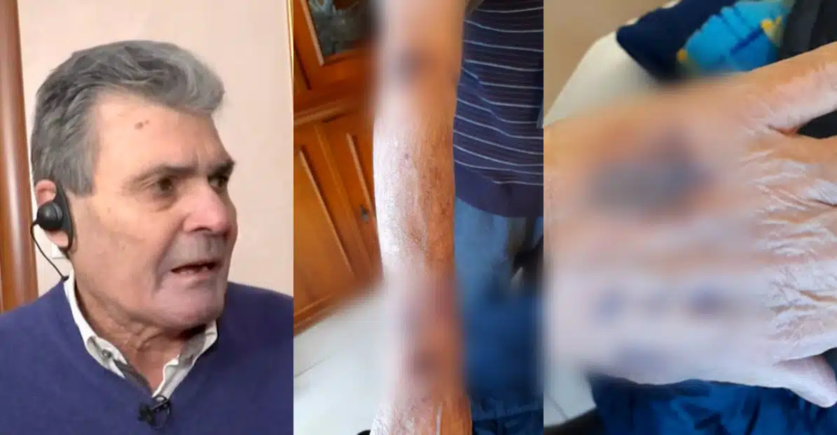 Una coppia di anziani è stata brutalmente aggredita a Lentate sul Seveso da rapinatori che hanno erroneamente creduto di trovare una cassaforte inesistente nella loro abitazione.