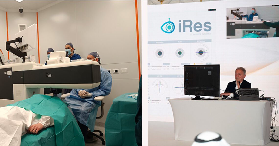 Riuscito il primo intervento di telechirurgia intercontinentale per il cheratocono: un chirurgo a Dubai controlla un laser a Bari.